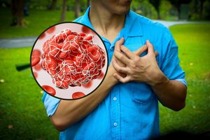 Kardiologai siunčia žinią: 4 simptomai išduoda kraujo krešulių ir insulto riziką