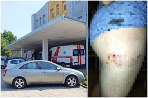 Kieme žaidžiantį 6-metį užpuolė ir apkandžiojo palaidas šuo: mama įspėja kitus tėvus