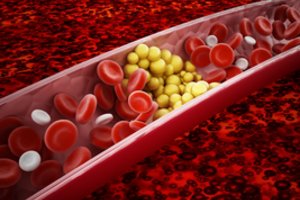 Mokslininkai atrado, kas mažina cholesterolio kiekį ir padeda numesti svorio