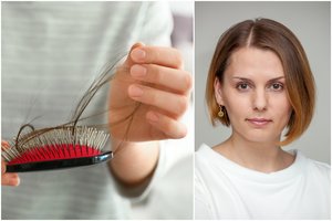 Slenka plaukai? Gydytoja patarė, kokių priemonių imtis