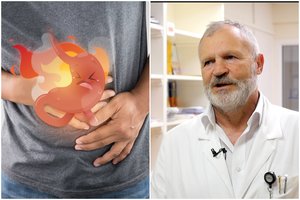 Refliuksas – klastingo vėžio požymis: gydytojas pasakė, kaip atpažinti pavojų