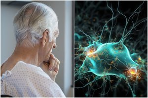 Hormonas, kuris apsaugo nuo Alzheimerio ligos: padidinti jo kiekį – visai paprasta