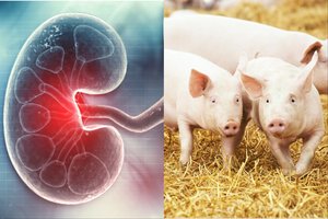 Pirmą kartą pavyko sėkmingai auginti žmogaus organą kito gyvūno kūne