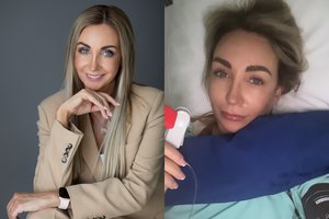 Gerda Žemaitė ryžosi naujai plastinei operacijai: išsiėmė krūtų implantus