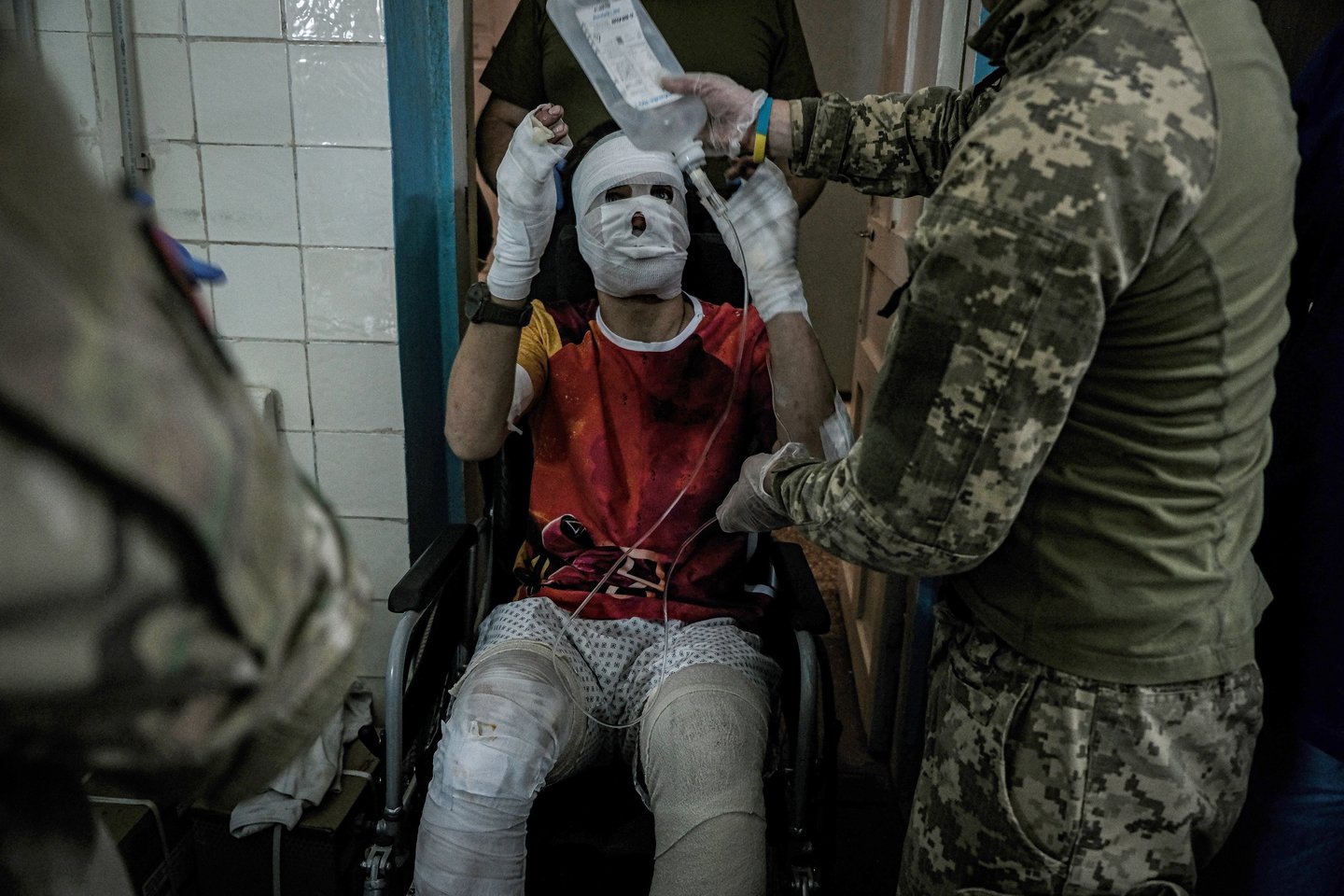 Karas Ukrainoje. Sužeisti ukrainiečių kariai.<br>EPA-ELTA nuotr.