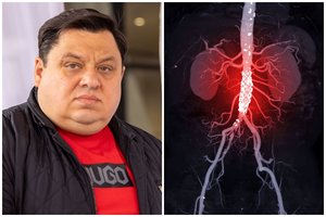 Klastinga „tylioji žudikė“: daugelis mėgaujasi gyvenimu ir nežino, kad jų laikas tiksi