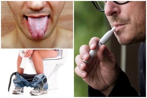 „Garintojo liežuvis“: keisti ir nemalonūs simptomai, kuriuos sukelia elektroninių cigarečių rūkymas