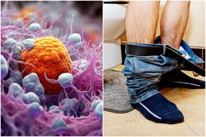 Įsidėmėkite: Lietuvoje ypač dažną vėžį išduoda 6 požymiai