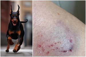 Neskiepytas ir agresyvus šuo terorizuoja Klaipėdos gyventojus: apkandžiojo jau ne vieną, bet niekas nesikeičia