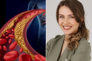 Padidėjo cholesterolio kiekis, bet noriu torto. Šeimos gydytoja pasakė, ką daryti