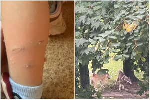 Siaubas Jurbarke: palaidi šunys drasko katinus, puldinėja žmones, kandžioja vaikus