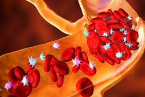 Išvardijo, kokie požymiai išduoda kraujo krešulį – delsti negalima