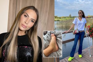 Simona Starkutė patyrė rimtą kojos traumą: „Tai man bus didelė pamoka“