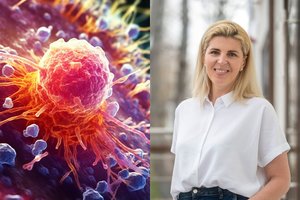 Chirurgė išvardijo ypač dažno vėžio požymius: delsti negalima