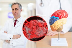 Nuo insulto Lietuvoje žmonės krenta vienas po kito: gydytojas prašo nedaryti šių klaidų