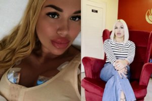 „Lapinų“ vadeivos žmona Aliona Lapinskienė ryžosi krūtinės mažinimo operacijai