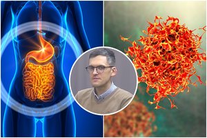 Paaiškėjo, kas stabdo vėžio ląsteles: atsakymas „nustebino net visko mačiusius“