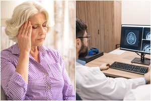 Gydytojas įspėja: galvos skausmas ir blogėjanti rega – klastingos smegenų ligos ženklai