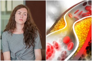 Kardiologė – apie cholesterolio kiekio kraujyje tyrimus: pacientai dažnai apsigauna