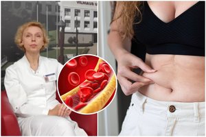 Troškulys ir svorio pokyčiai – klastingos ligos ženklai: tūkstančiai lietuvių nenutuokia, kad ja serga