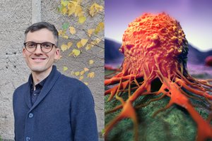 Blogiau nei rūkymas: įvardijo pagrindinę vėžio atsiradimo priežastį