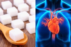 Būtinas, bet mirtinas? Profesorė pasakė, kiek cukraus kenkia sveikatai