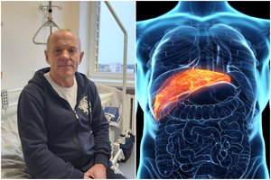 Baisus skausmas Joną surakino nėtikėtai: paaiškėjo, kad serga kepenų vėžiu