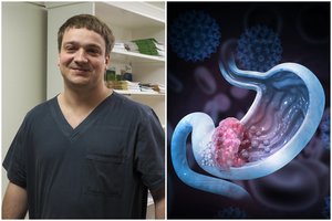 Skrandžio vėžys – klastinga liga: chirurgas išvardijo jos simptomus