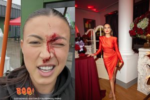 Savaitės blykstėse – Eglės Jakštytės pralietas kraujas ir stulbinantis Astos Manchester įvaizdis