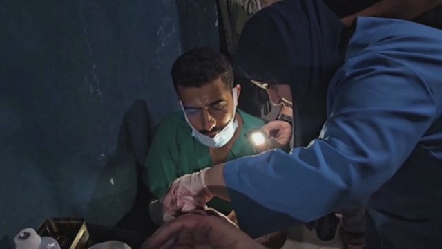Izraelio ir „Hamas“ susirėmimai paralyžiavo Gazos ligonines: likę viduje be maisto ir vandens įkalinti tamsoje 