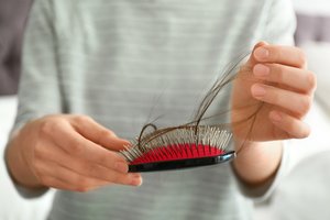 Kiek plaukų prarasti per dieną yra normalu? Atsako šeimos gydytoja