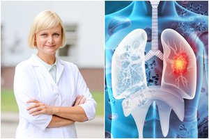 Plaučių vėžys – ne tik rūkančiųjų liga: simptomai, į kuriuos negalima numoti ranka