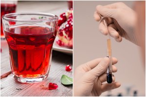 Rūpi jūsų kraujo kokybė? Medikai pataria gerti tai kiekvieną dieną