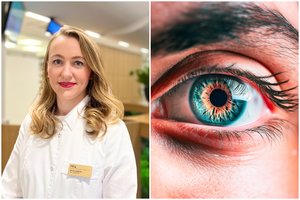 „Juodi taškeliai“ akyse: gydytoja įspėja – negalima delsti