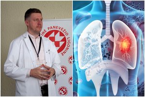 Užsitęsęs kosulys ir krūtinės skausmas – klastingos ligos pranašai