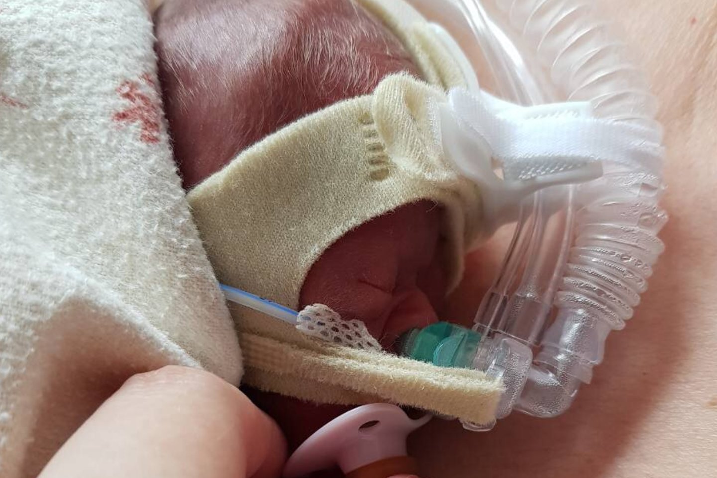  Identiškos dvynės Viltė ir Ieva Veronikai ir Vytautui gimė 23 nėštumo savaitę.<br> Asmeninio albumo nuotr.