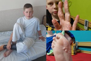 Kūną deformuojančia liga sergantį sūnų auginančiai joniškietei smogė dar viena nelaimė: „Gyvename kaip ant adatų“