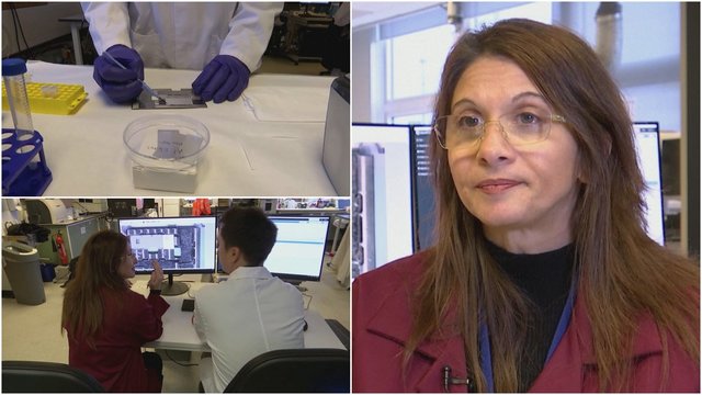 JK mokslininkai skelbia atradę neskausmingą būdą vėžio ląstelėms nustatyti: tereikia piršto antspaudo