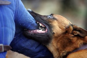 Įkando gyvūnas: kada reikia skubėti pas medikus?