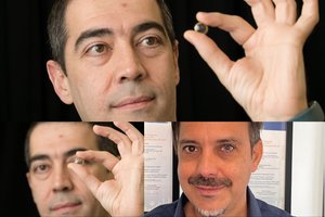 Sukūrė kontaktinius lęšius, kurie padeda diagnozuoti klastingą regėjimą atimančią ligą