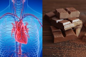 Ar šokoladas mažina kraujospūdį? Tyrimas pateikė atsakymą