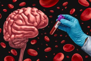 Kelią skinasi naujas būdas Alzheimerio ligai nustatyti: tirtų visus nuo 50 metų