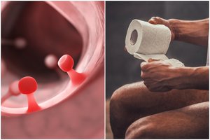 Ypač klastingas vėžys pražudo vis daugiau žmonių: liga išsiduoda tualete