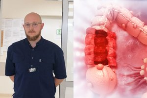 Gydytojas kreipėsi į visus vyresnius nei 50 metų: įspėjo dėl Lietuvoje dažno vėžio