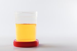 Kodėl šlapimas yra geltonas? Tai paaiškėjo tik dabar