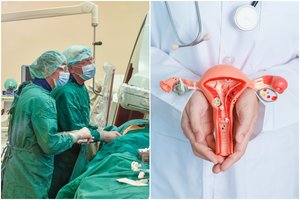 Vėžio tipas, kurį Lietuva galėtų išnaikinti: dabar liga pražudo šimtus moterų