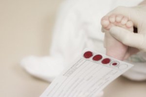 Įvardijo ligas dėl kurių jau metus vykdoma papildoma visuotinė naujagimių patikra: pasakė, kaip ji vyksta