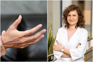 Gausus prakaitas ir rankų drebuliai – dažno sveikatos sutrikimo ženklai