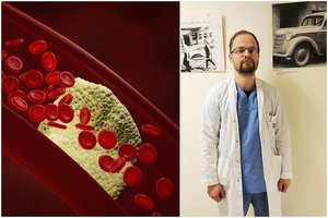 Kraujagyslių chirurgas atsakė, kokią ligą išduoda kojų skausmas: negalima delsti