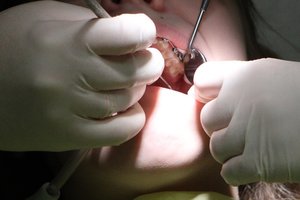 VLK atsakė, kam odontologinės paslaugos priklauso nemokamai